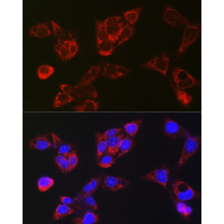 Immunofluorescence - Anti-LBP Antibody (A92519) - Antibodies.com