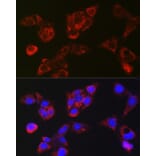Immunofluorescence - Anti-LBP Antibody (A92519) - Antibodies.com