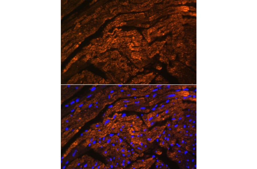 Immunofluorescence - Anti-Titin Antibody (A92520) - Antibodies.com