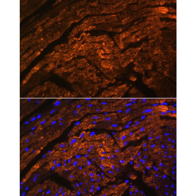Immunofluorescence - Anti-Titin Antibody (A92520) - Antibodies.com