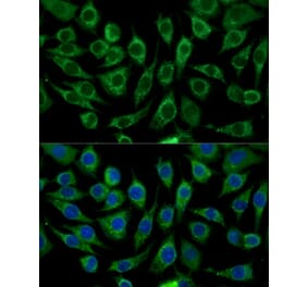 Immunofluorescence - Anti-ABCD2 Antibody (A92521) - Antibodies.com