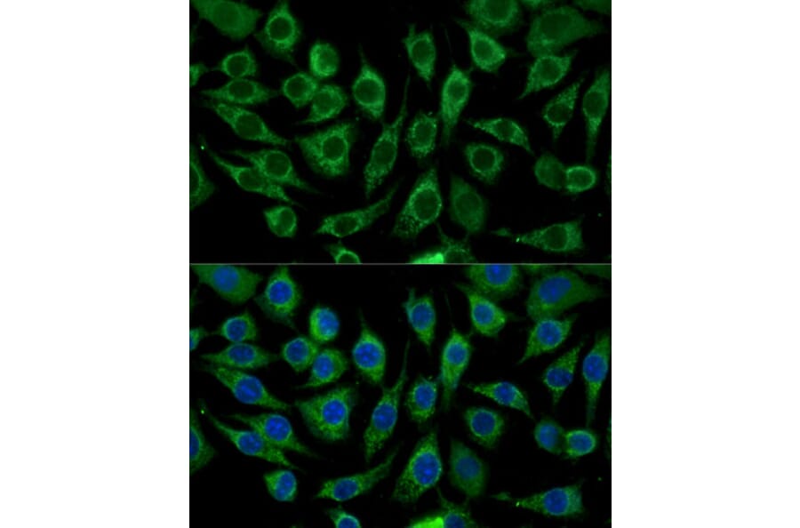 Immunofluorescence - Anti-ABCD2 Antibody (A92521) - Antibodies.com