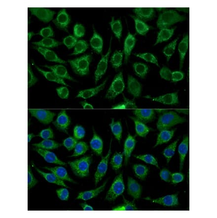 Immunofluorescence - Anti-ABCD2 Antibody (A92521) - Antibodies.com