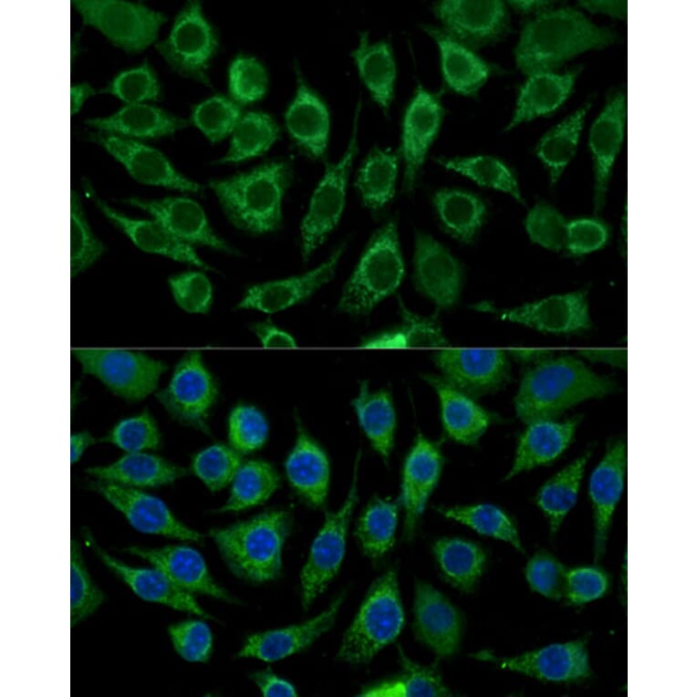 Immunofluorescence - Anti-ABCD2 Antibody (A92521) - Antibodies.com