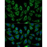 Immunofluorescence - Anti-ABCD2 Antibody (A92521) - Antibodies.com