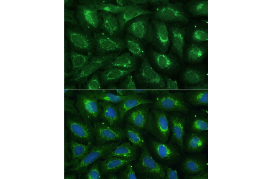 Immunofluorescence - Anti-ABCD2 Antibody (A92521) - Antibodies.com