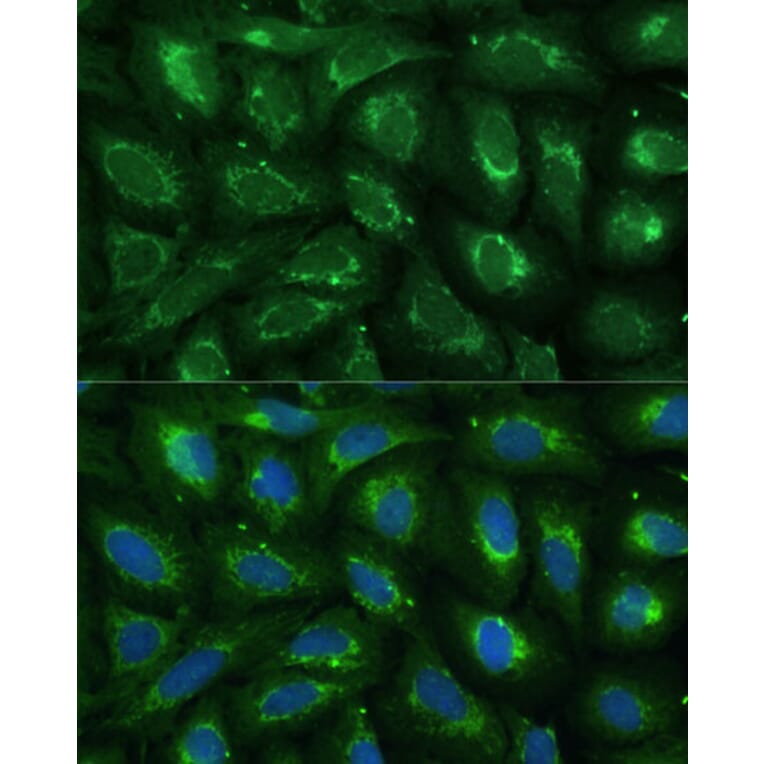Immunofluorescence - Anti-ABCD2 Antibody (A92521) - Antibodies.com
