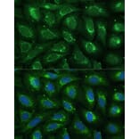 Immunofluorescence - Anti-ABCD2 Antibody (A92521) - Antibodies.com
