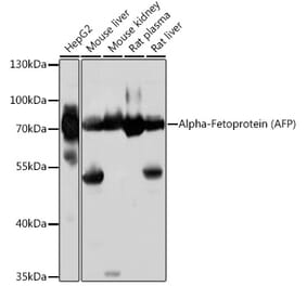 Western Blot - Anti-alpha 1 Fetoprotein Antibody (A92524) - Antibodies.com