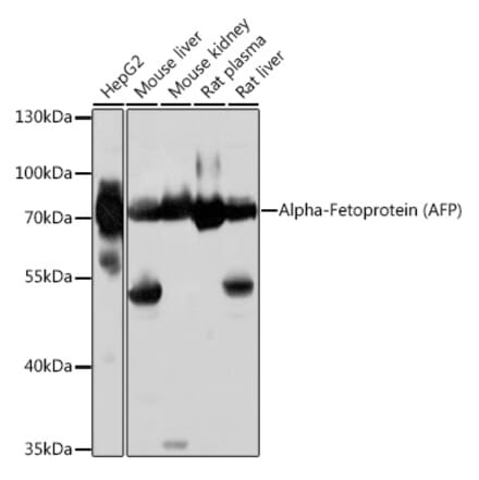 Western Blot - Anti-alpha 1 Fetoprotein Antibody (A92524) - Antibodies.com