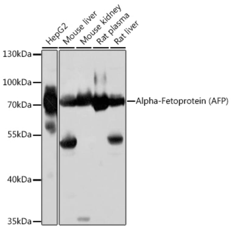 Western Blot - Anti-alpha 1 Fetoprotein Antibody (A92524) - Antibodies.com