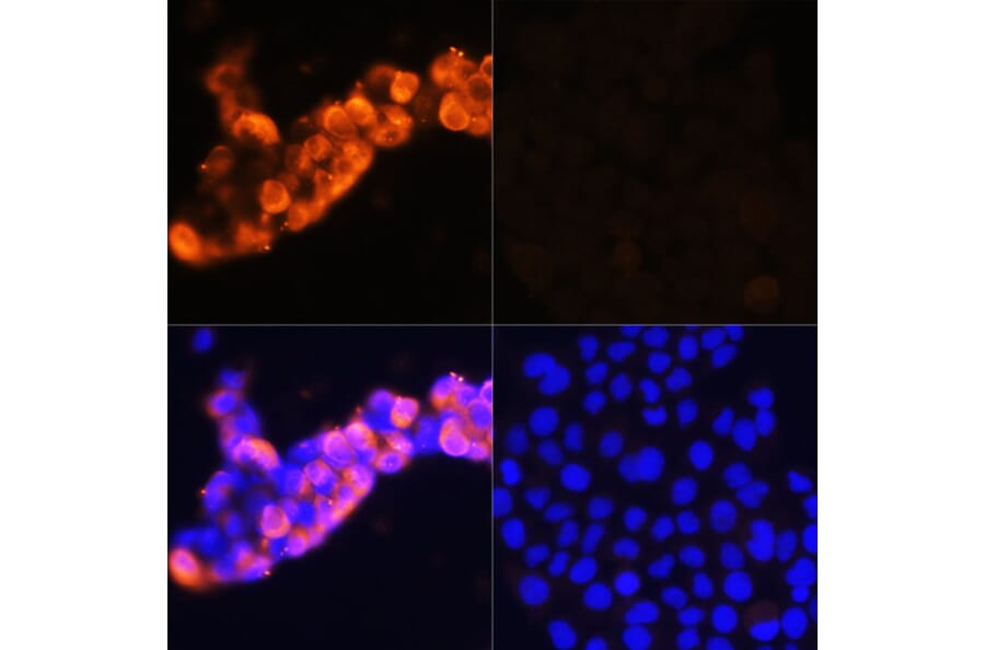Immunofluorescence - Anti-alpha 1 Fetoprotein Antibody (A92524) - Antibodies.com