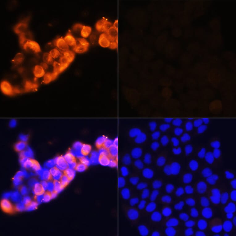 Immunofluorescence - Anti-alpha 1 Fetoprotein Antibody (A92524) - Antibodies.com
