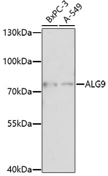 Western blot analysis of extracts of various cell lines, using Anti-ALG9 Antibody (A17213) at 1:1,000 dilution.
Secondary antibody: Goat Anti-Rabbit IgG (H+L) (HRP) (AS014) at 1:10,000 dilution.
Lysates / proteins: 25µg per lane.
Blocking buffer: 3% non-fat dry milk in TBST.
Detection: ECL Enhanced Kit (RM00021).
Exposure time: 90s.