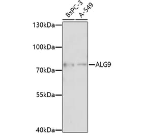 Western Blot - Anti-ALG9 Antibody (A92526) - Antibodies.com