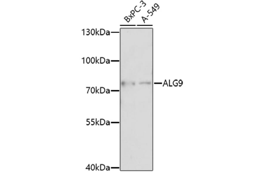Western Blot - Anti-ALG9 Antibody (A92526) - Antibodies.com