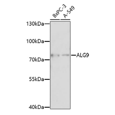 Western Blot - Anti-ALG9 Antibody (A92526) - Antibodies.com