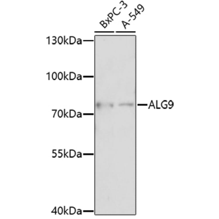 Western Blot - Anti-ALG9 Antibody (A92526) - Antibodies.com