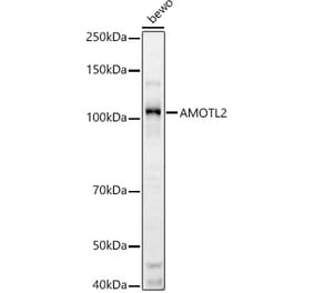 Western Blot - Anti-AMOTL2 Antibody (A92527) - Antibodies.com