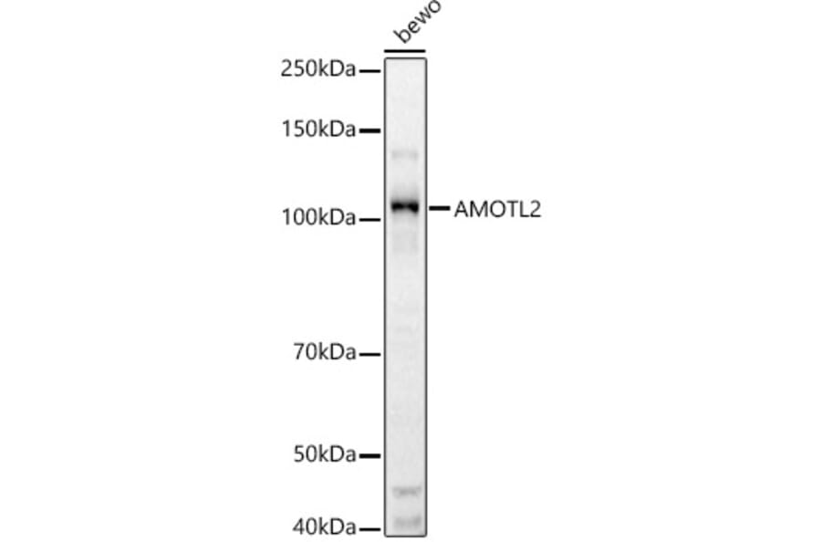 Western Blot - Anti-AMOTL2 Antibody (A92527) - Antibodies.com