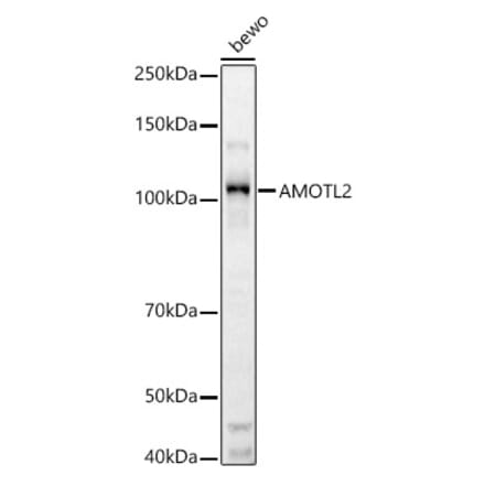 Western Blot - Anti-AMOTL2 Antibody (A92527) - Antibodies.com
