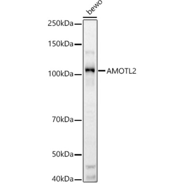 Western Blot - Anti-AMOTL2 Antibody (A92527) - Antibodies.com