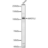 Western Blot - Anti-AMOTL2 Antibody (A92527) - Antibodies.com