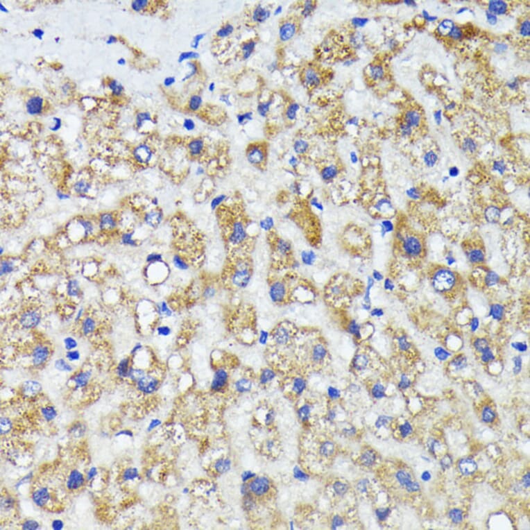 Immunohistochemistry - Anti-AMOTL2 Antibody (A92527) - Antibodies.com