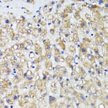 Immunohistochemistry - Anti-AMOTL2 Antibody (A92527) - Antibodies.com