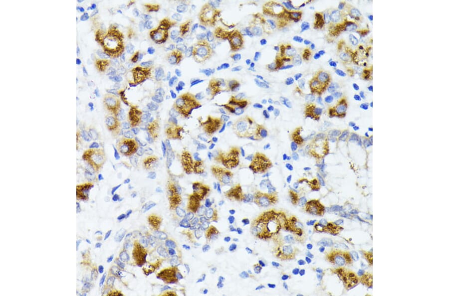 Immunohistochemistry - Anti-AMOTL2 Antibody (A92527) - Antibodies.com