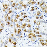 Immunohistochemistry - Anti-AMOTL2 Antibody (A92527) - Antibodies.com