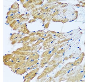 Immunohistochemistry - Anti-ARHGEF5 Antibody (A92536) - Antibodies.com