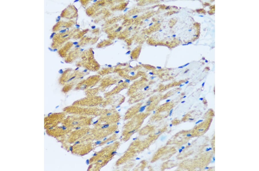 Immunohistochemistry - Anti-ARHGEF5 Antibody (A92536) - Antibodies.com