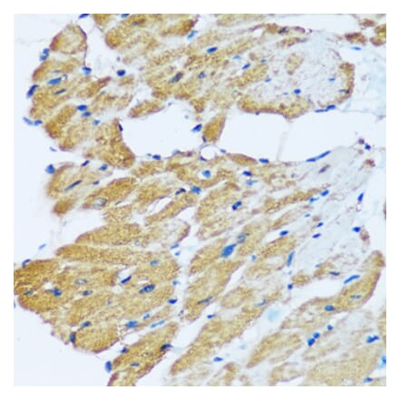 Immunohistochemistry - Anti-ARHGEF5 Antibody (A92536) - Antibodies.com