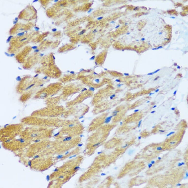 Immunohistochemistry - Anti-ARHGEF5 Antibody (A92536) - Antibodies.com