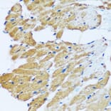 Immunohistochemistry - Anti-ARHGEF5 Antibody (A92536) - Antibodies.com