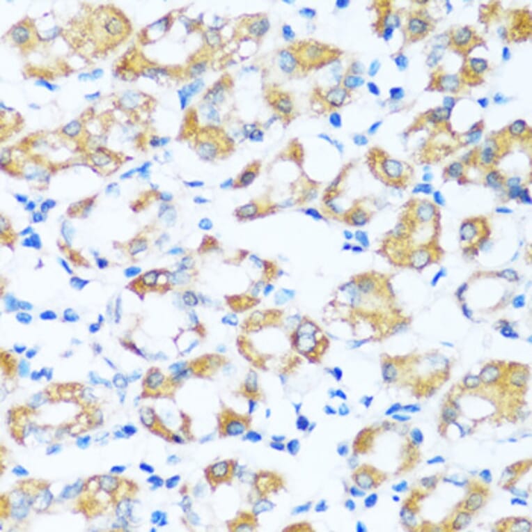Immunohistochemistry - Anti-ARHGEF5 Antibody (A92536) - Antibodies.com