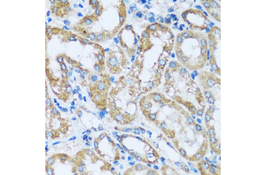 Immunohistochemistry - Anti-ARHGEF5 Antibody (A92536) - Antibodies.com