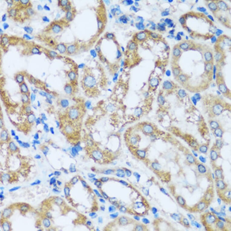 Immunohistochemistry - Anti-ARHGEF5 Antibody (A92536) - Antibodies.com