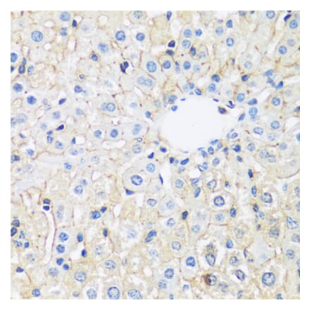 Immunohistochemistry - Anti-ARL4A Antibody (A92537) - Antibodies.com