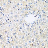 Immunohistochemistry - Anti-ARL4A Antibody (A92537) - Antibodies.com