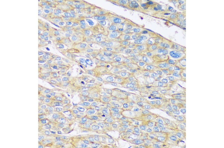 Immunohistochemistry - Anti-ARL4A Antibody (A92537) - Antibodies.com