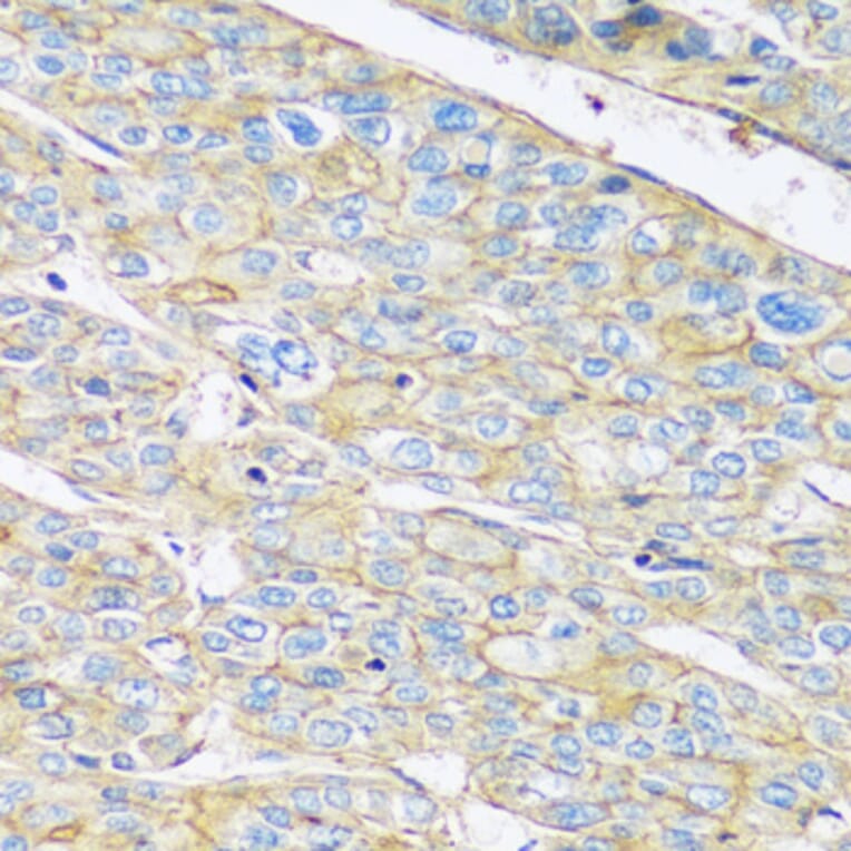 Immunohistochemistry - Anti-ARL4A Antibody (A92537) - Antibodies.com