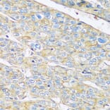 Immunohistochemistry - Anti-ARL4A Antibody (A92537) - Antibodies.com