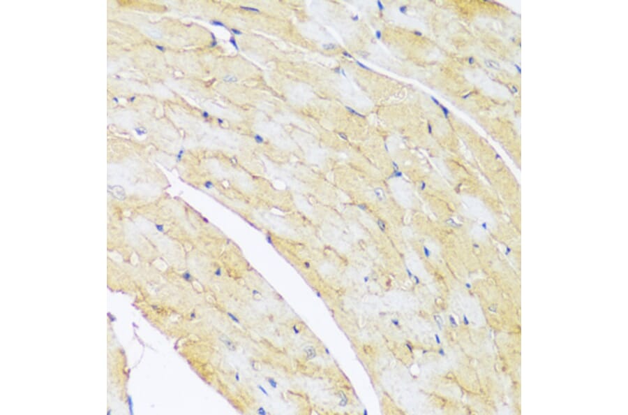 Immunohistochemistry - Anti-ARL4A Antibody (A92537) - Antibodies.com
