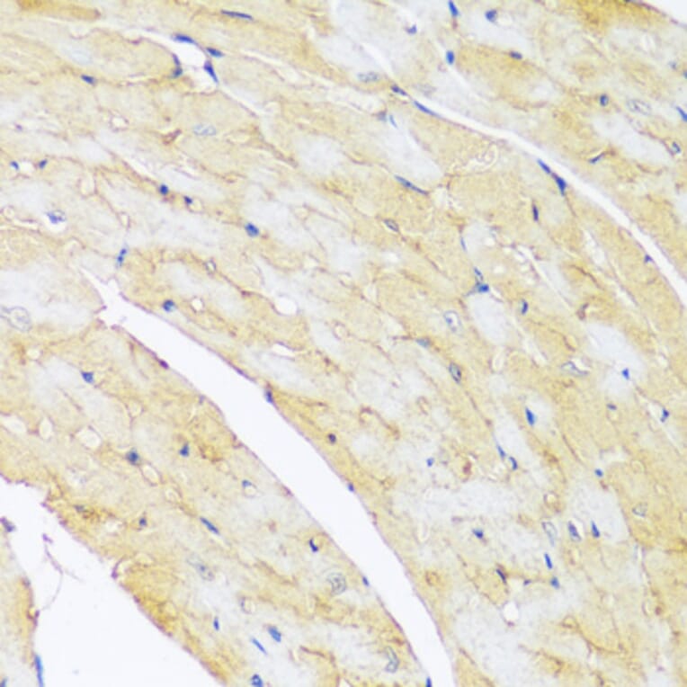 Immunohistochemistry - Anti-ARL4A Antibody (A92537) - Antibodies.com