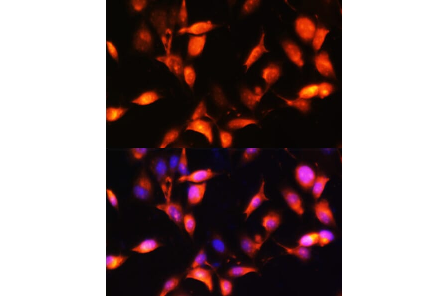 Immunofluorescence - Anti-ARL4A Antibody (A92537) - Antibodies.com