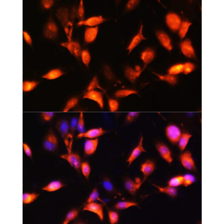 Immunofluorescence - Anti-ARL4A Antibody (A92537) - Antibodies.com