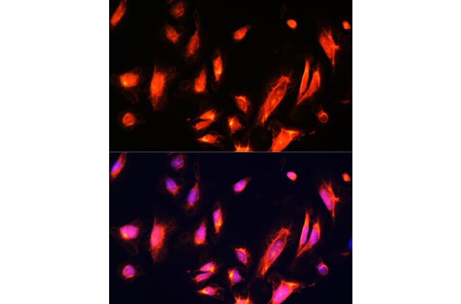 Immunofluorescence - Anti-ARL4A Antibody (A92537) - Antibodies.com