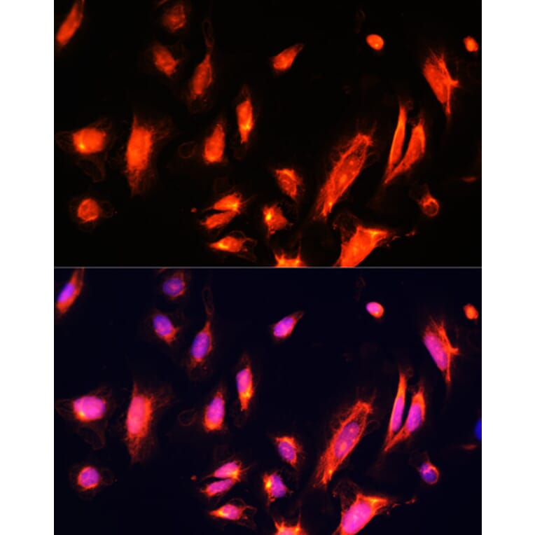 Immunofluorescence - Anti-ARL4A Antibody (A92537) - Antibodies.com